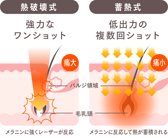 熱破壊式と蓄熱式の主な違い