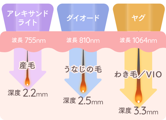 「アレキサンドライト」「ダイオード」「ヤグ」