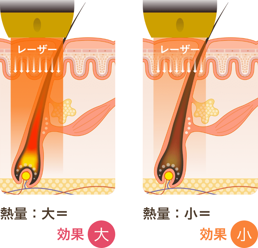 熱量：大＝効果大、熱量：小＝効果小