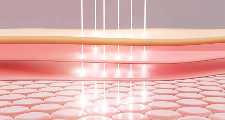 出力×照射数＝総熱量