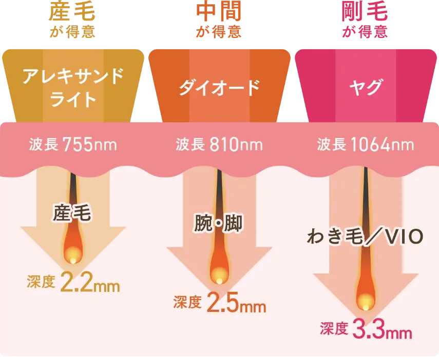 ３波長同時照射でどんな毛も一網打尽